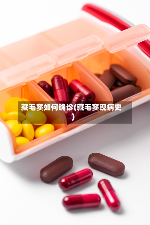 藏毛窦如何确诊(藏毛窦现病史)