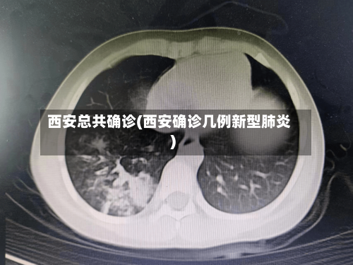 西安总共确诊(西安确诊几例新型肺炎)