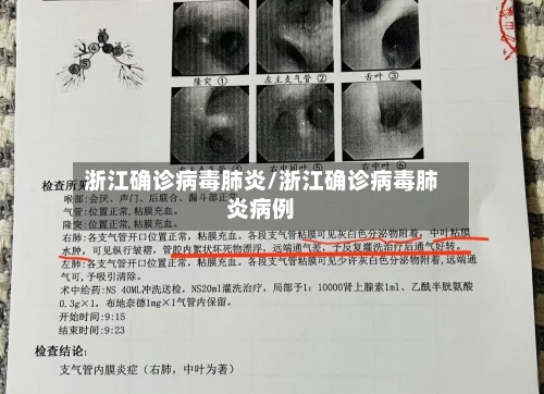 浙江确诊病毒肺炎/浙江确诊病毒肺炎病例-第3张图片