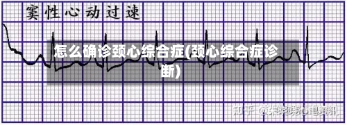 怎么确诊颈心综合症(颈心综合症诊断)