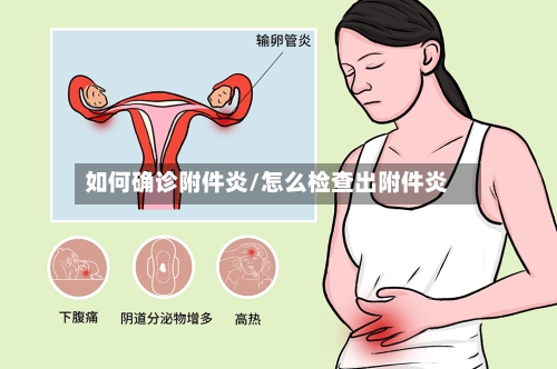 如何确诊附件炎/怎么检查出附件炎