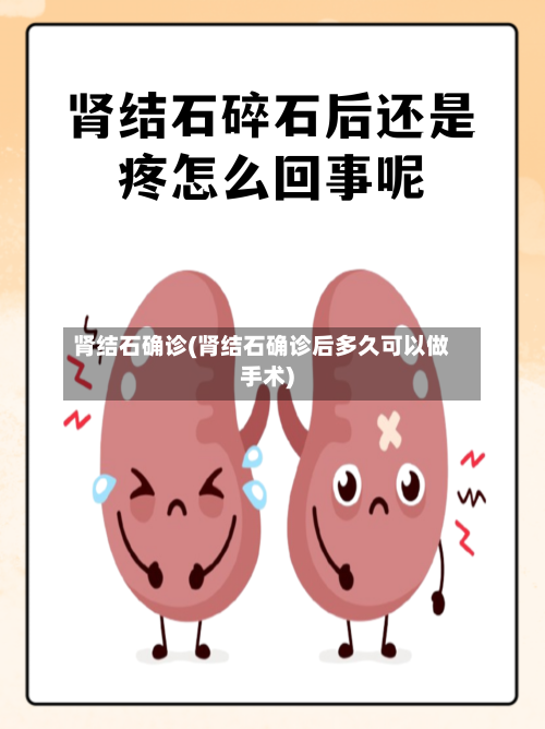肾结石确诊(肾结石确诊后多久可以做手术)-第3张图片