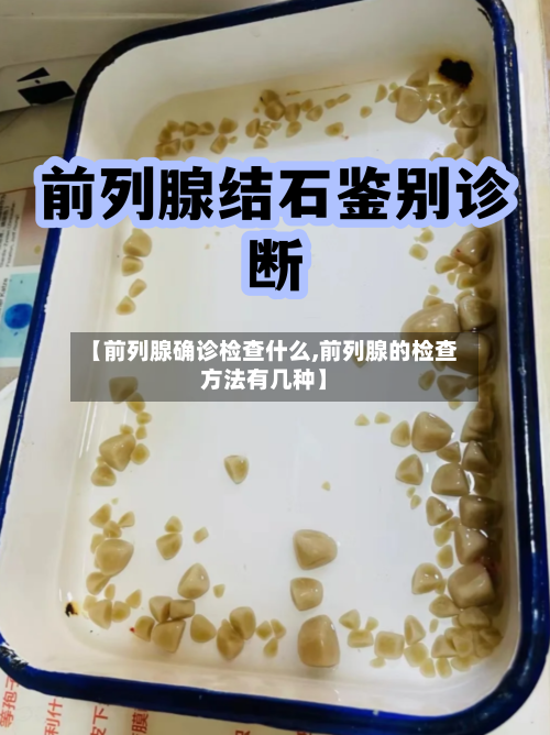 【前列腺确诊检查什么,前列腺的检查方法有几种】-第2张图片