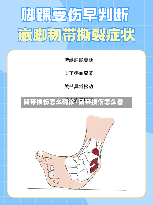 韧带损伤怎么确诊/韧带损伤怎么看-第3张图片