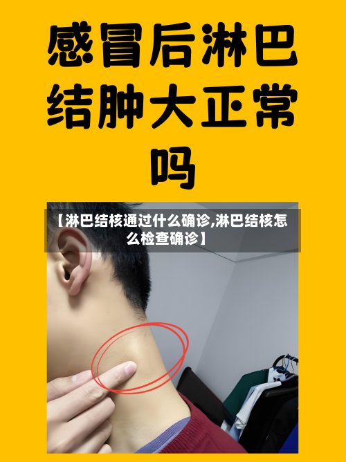 【淋巴结核通过什么确诊,淋巴结核怎么检查确诊】-第2张图片