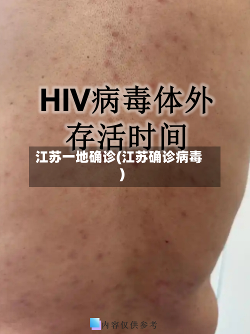 江苏一地确诊(江苏确诊病毒)-第2张图片