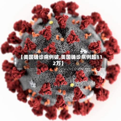 【美国确诊病例破,美国确诊病例超112万】-第1张图片