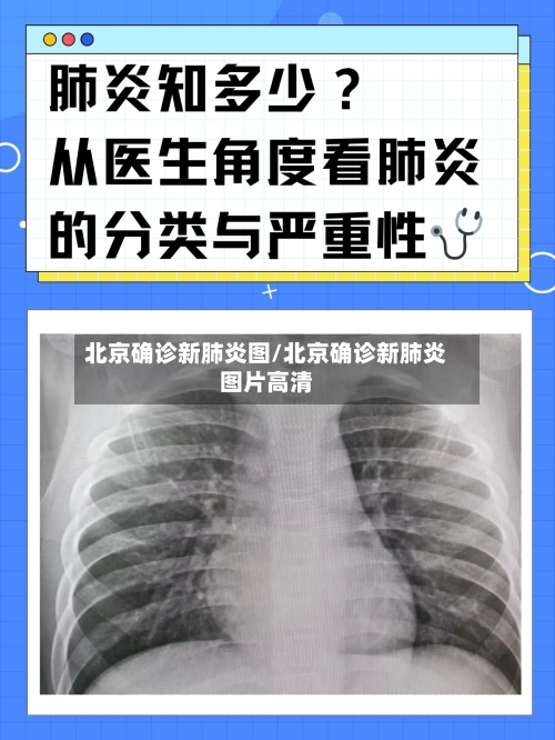 北京确诊新肺炎图/北京确诊新肺炎图片高清-第1张图片