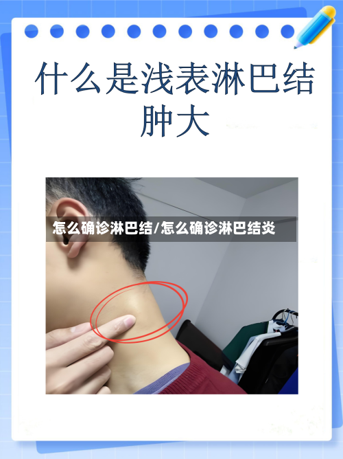 怎么确诊淋巴结/怎么确诊淋巴结炎
